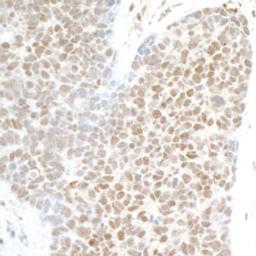 Detection of human PHF8 by immunohistochemistry.