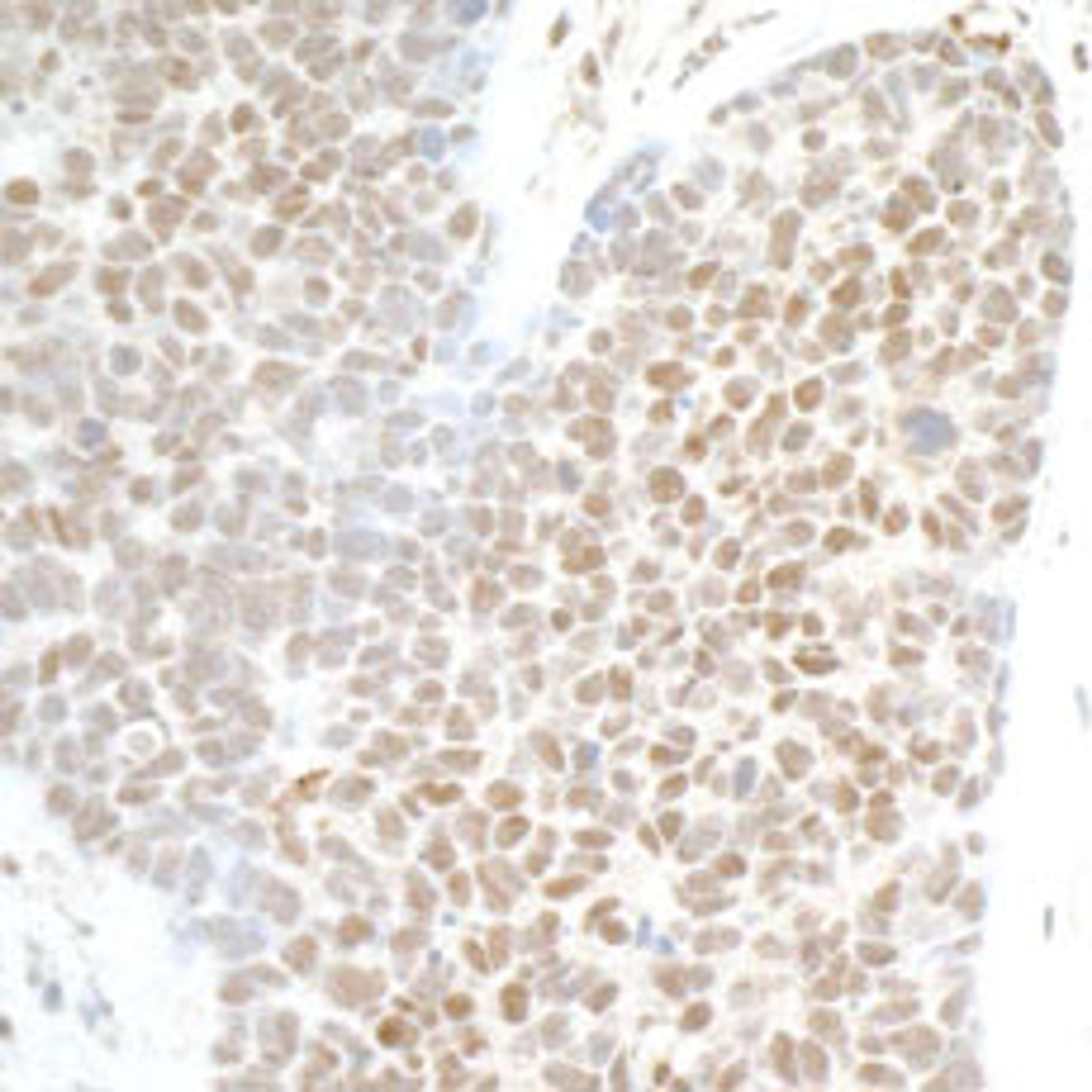 Detection of human PHF8 by immunohistochemistry.