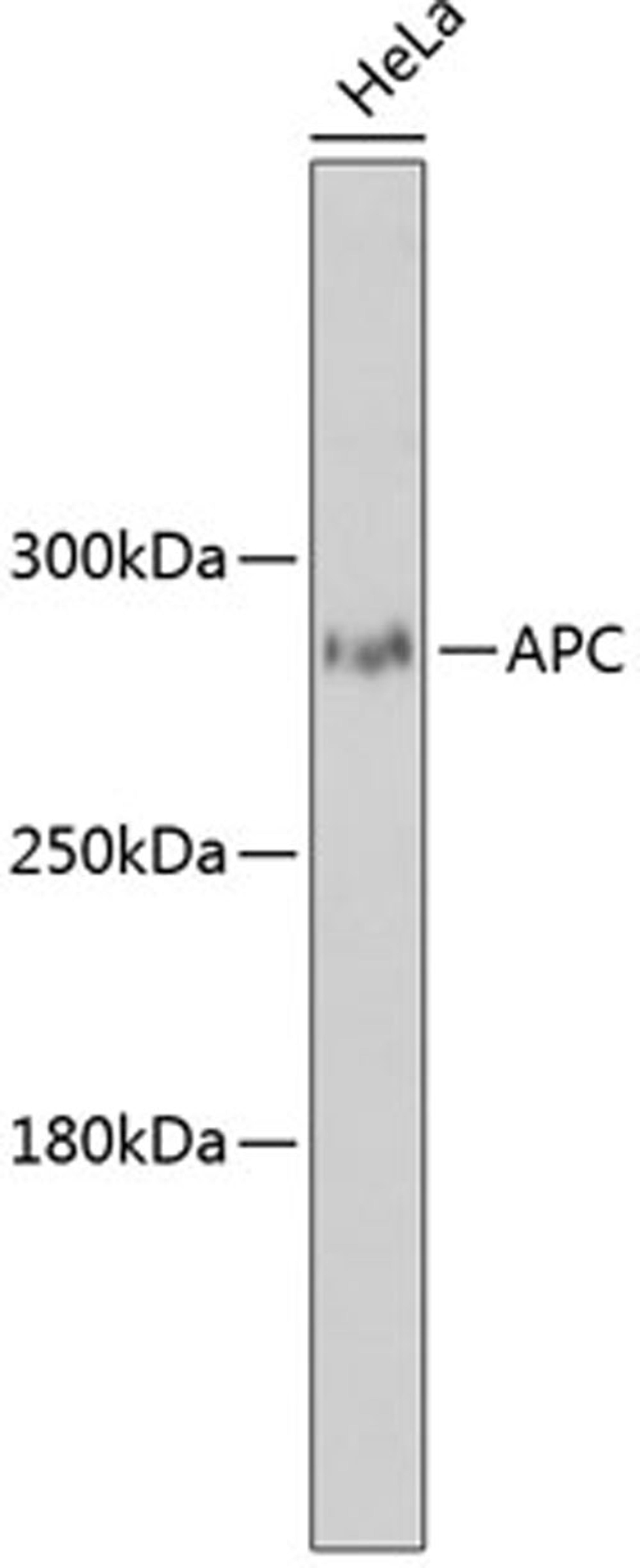 Western blot - APC antibody (A2818)