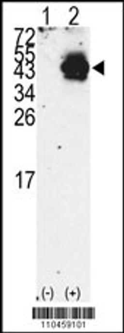 Western blot analysis of PDX1 using rabbit polyclonal PDX1 Antibody using 293 cell lysates (2 ug/lane) either nontransfected (Lane 1) or transiently transfected with the PDX1 gene (Lane 2).