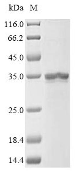 (Tris-Glycine gel) Discontinuous SDS-PAGE (reduced) with 5% enrichment gel and 15% separation gel.