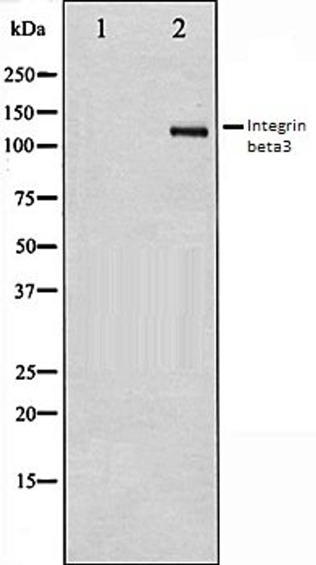 Western blot analysis of HepG2 whole cell lysates using Integrin beta3 antibody, The lane on the left is treated with the antigen-specific peptide.