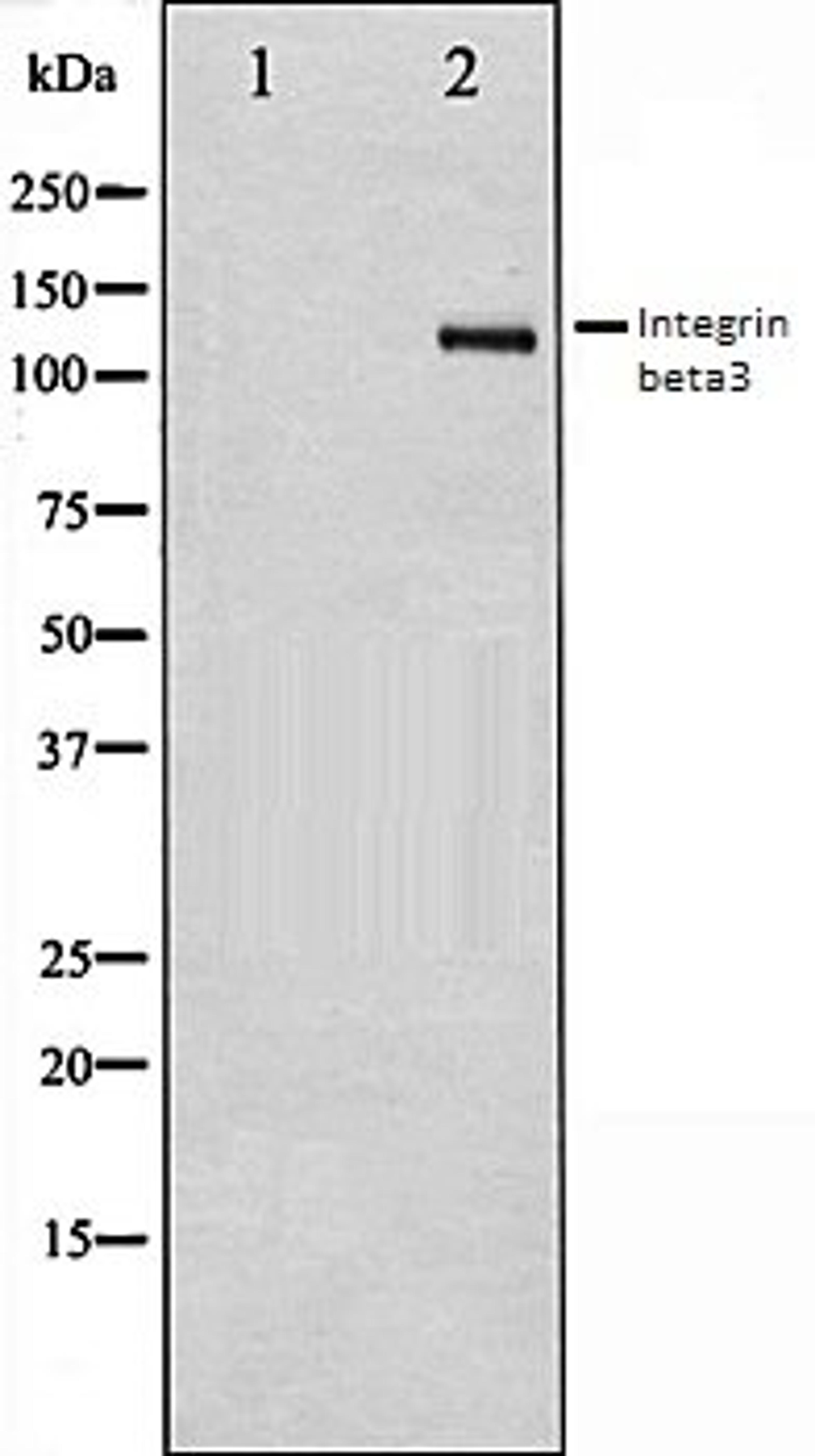 Western blot analysis of HepG2 whole cell lysates using Integrin beta3 antibody, The lane on the left is treated with the antigen-specific peptide.