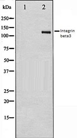 Western blot analysis of HepG2 whole cell lysates using Integrin beta3 antibody, The lane on the left is treated with the antigen-specific peptide.