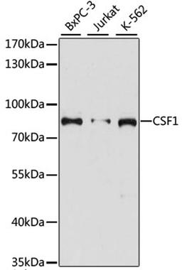 Western blot - CSF1 antibody (A1627)