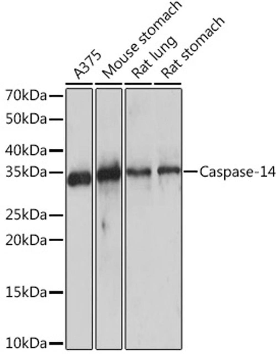 Western blot - Caspase-14 Rabbit mAb (A9618)