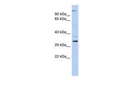 Antibody used in WB on Human Brain at 0.2-1 ug/ml.