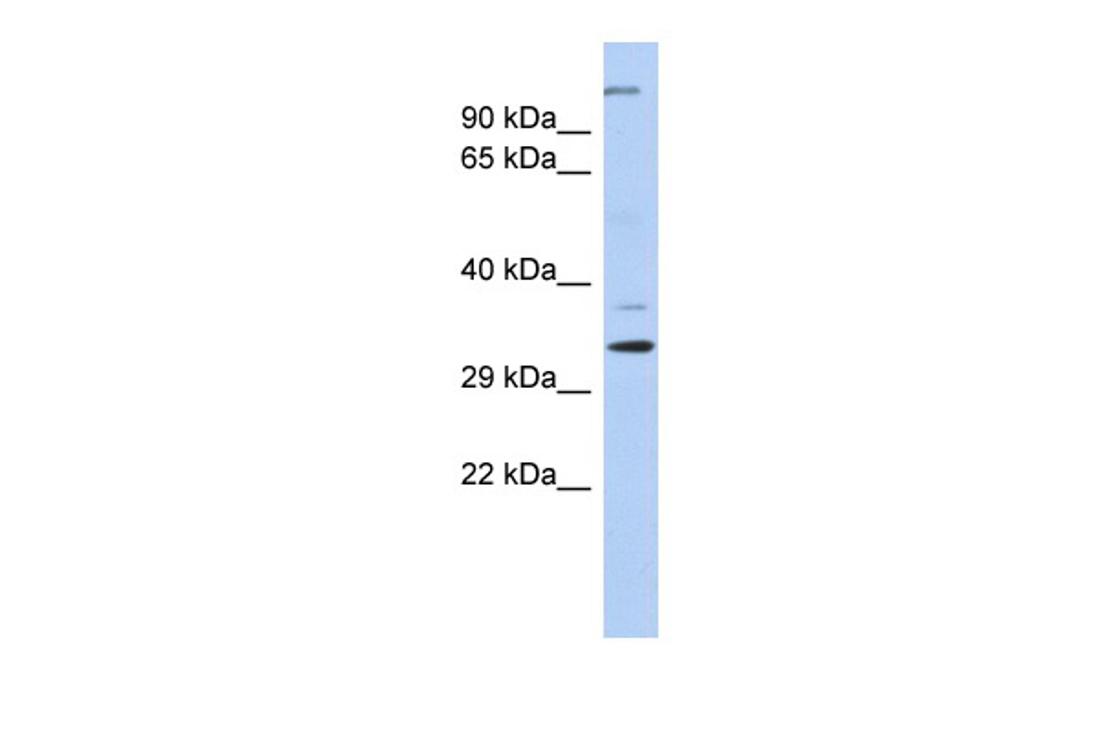 Antibody used in WB on Human Brain at 0.2-1 ug/ml.