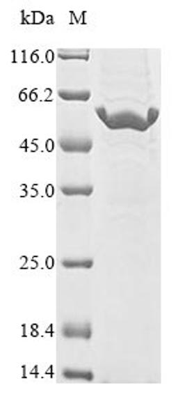 (Tris-Glycine gel) Discontinuous SDS-PAGE (reduced) with 5% enrichment gel and 15% separation gel.