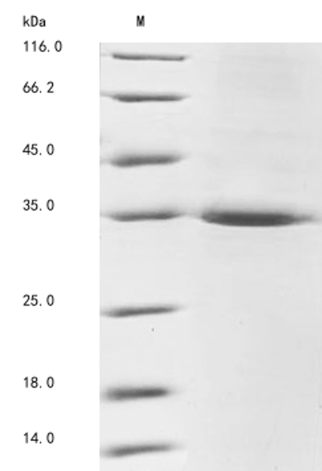 (Tris-Glycine gel) Discontinuous SDS-PAGE (reduced) with 5% enrichment gel and 15% separation gel.
