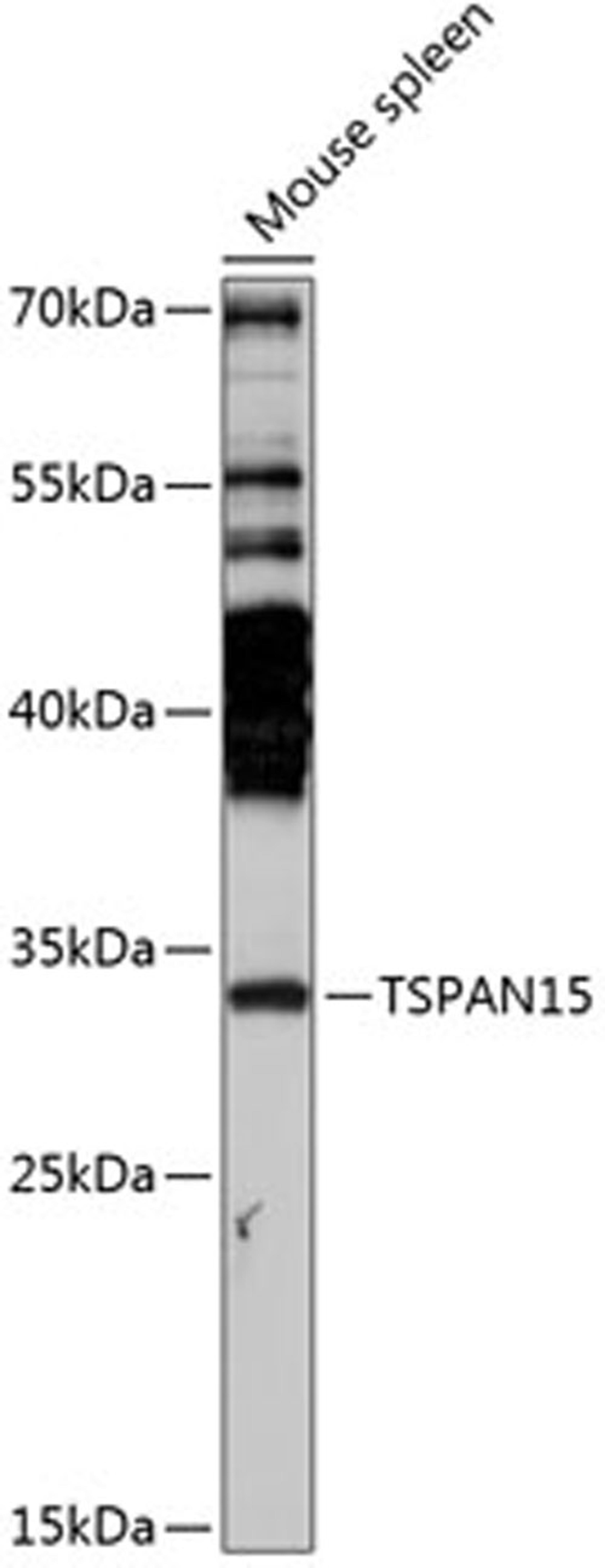 Western blot - TSPAN15 antibody (A14395)