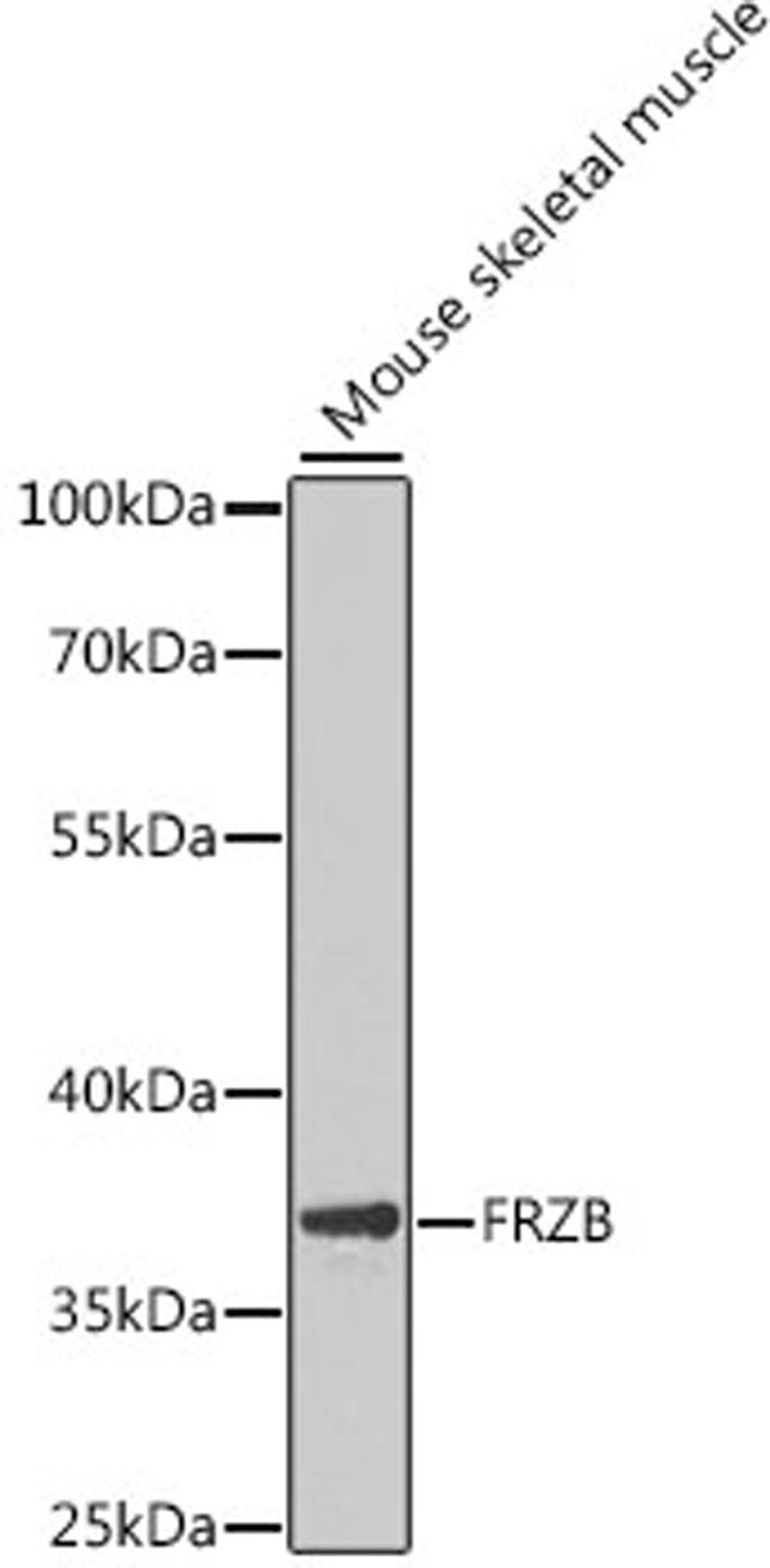 Western blot - FRZB antibody (A6592)