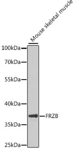 Western blot - FRZB antibody (A6592)