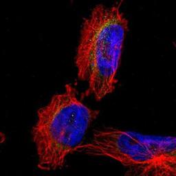 Immunocytochemistry/Immunofluorescence: MFF Antibody [NBP1-86799] Staining of human cell line U-251MG shows positivity in cytoplasm.