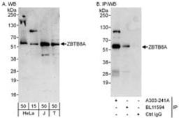 Detection of human ZBTB8A by western blot and immunoprecipitation.