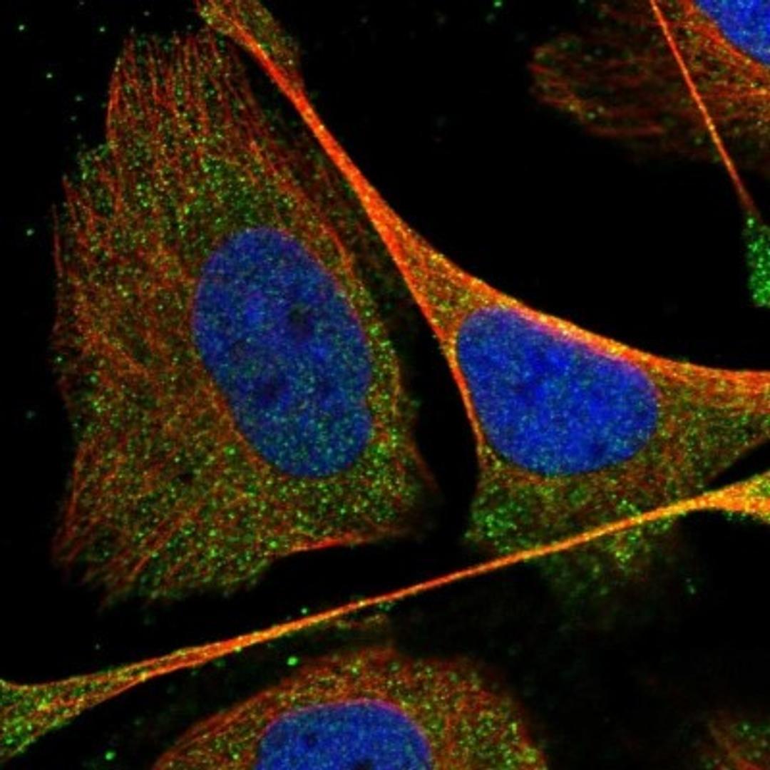 Immunocytochemistry/Immunofluorescence: PPP1R3C Antibody [NBP1-87236] - Staining of human cell line U-2 OS shows positivity in nucleus but not nucleoli & cytoplasm.