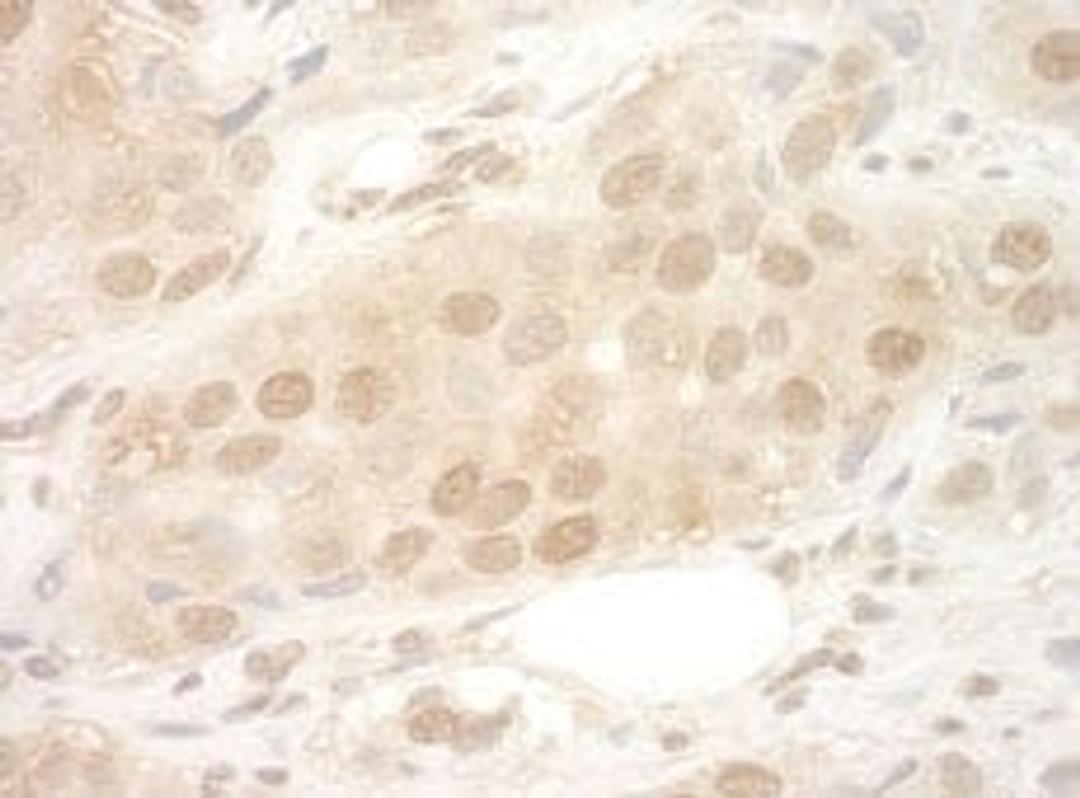 Detection of human eIF2B5 by immunohistochemistry.