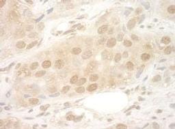 Detection of human eIF2B5 by immunohistochemistry.