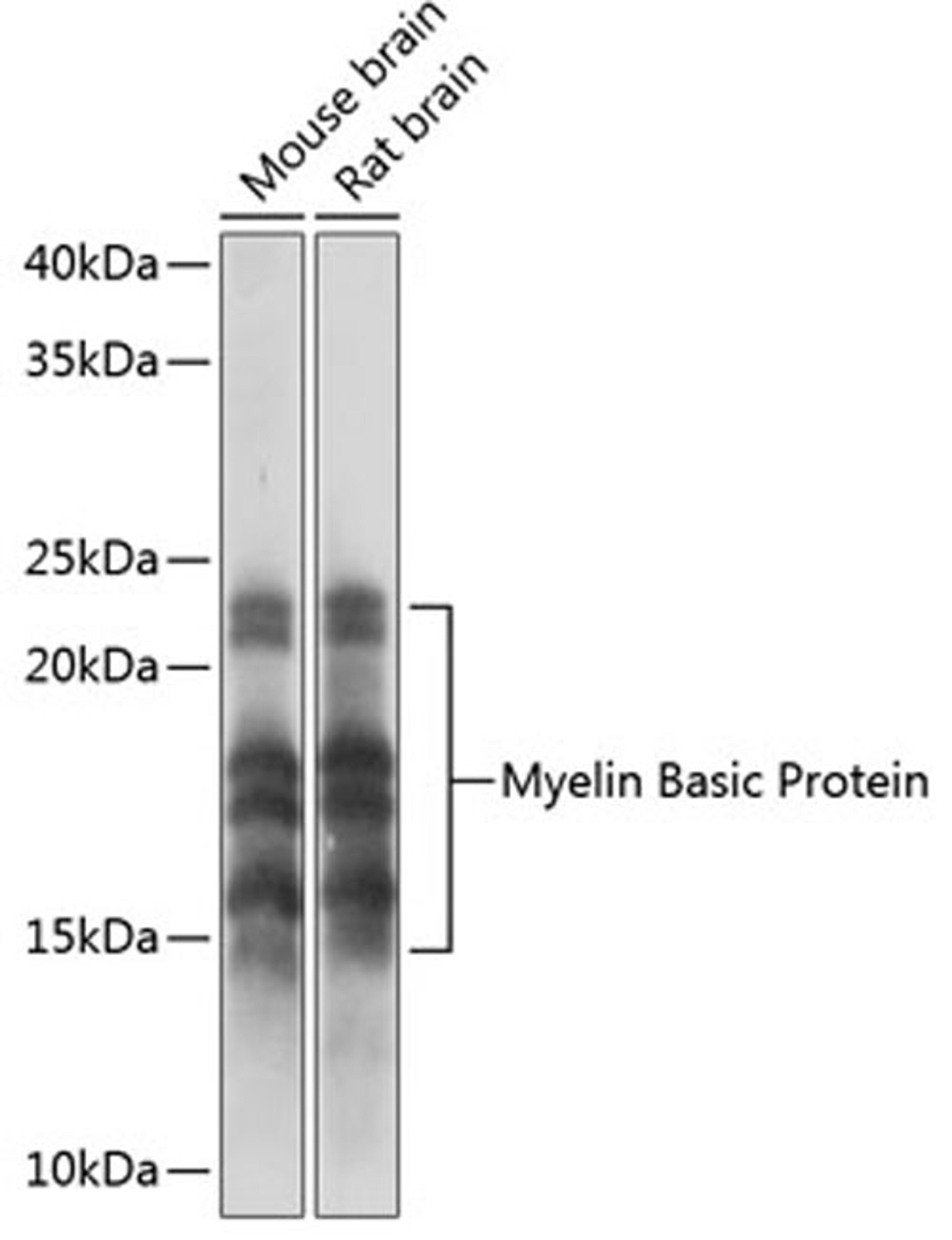 Western blot - Myelin Basic Protein Rabbit mAb (A11162)