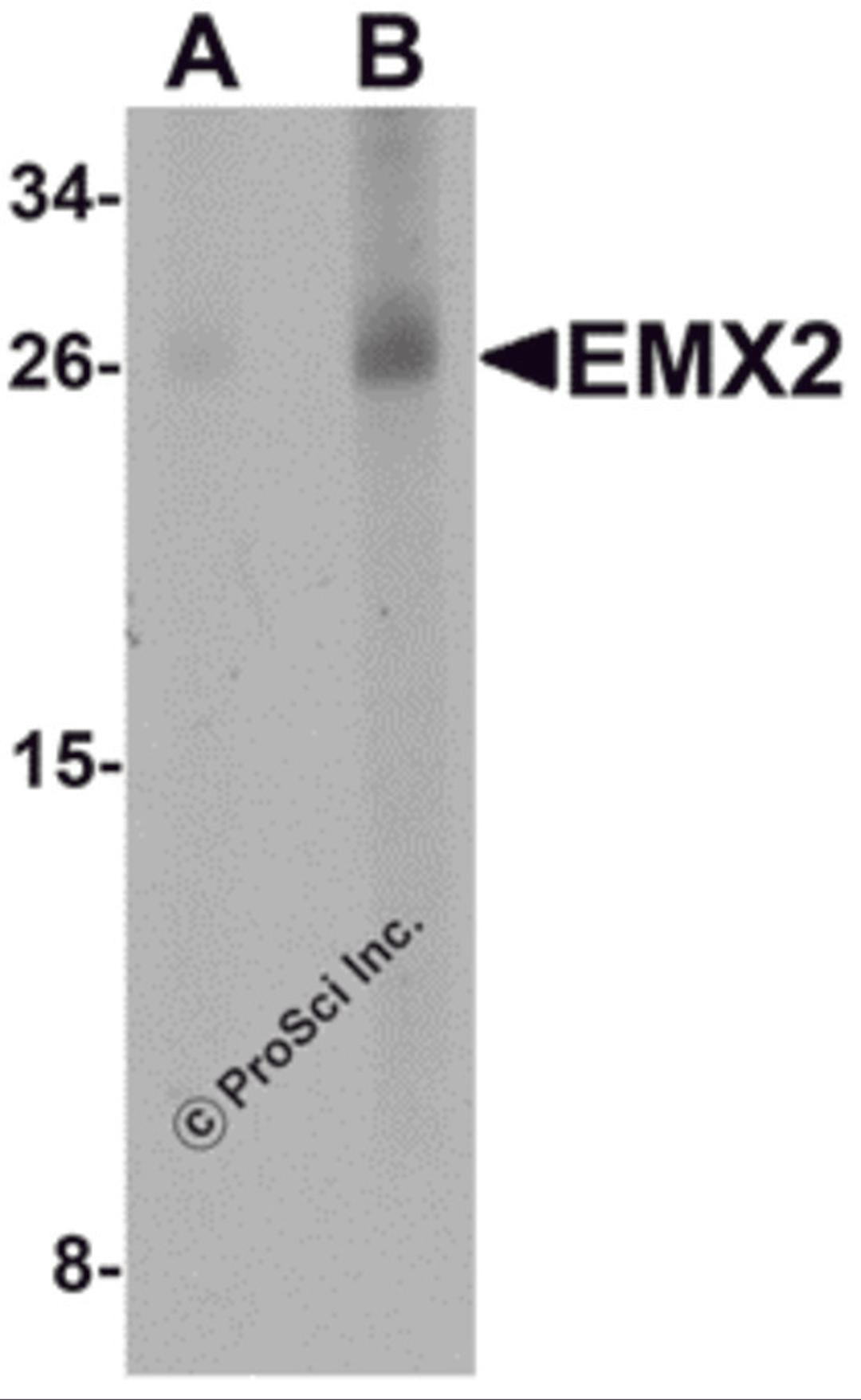 Western blot analysis of EMX2 in human lung tissue lysate with EMX2 antibody at (A) 1 and (B) 2 &#956;g/mL.