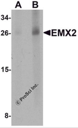 Western blot analysis of EMX2 in human lung tissue lysate with EMX2 antibody at (A) 1 and (B) 2 μg/mL.