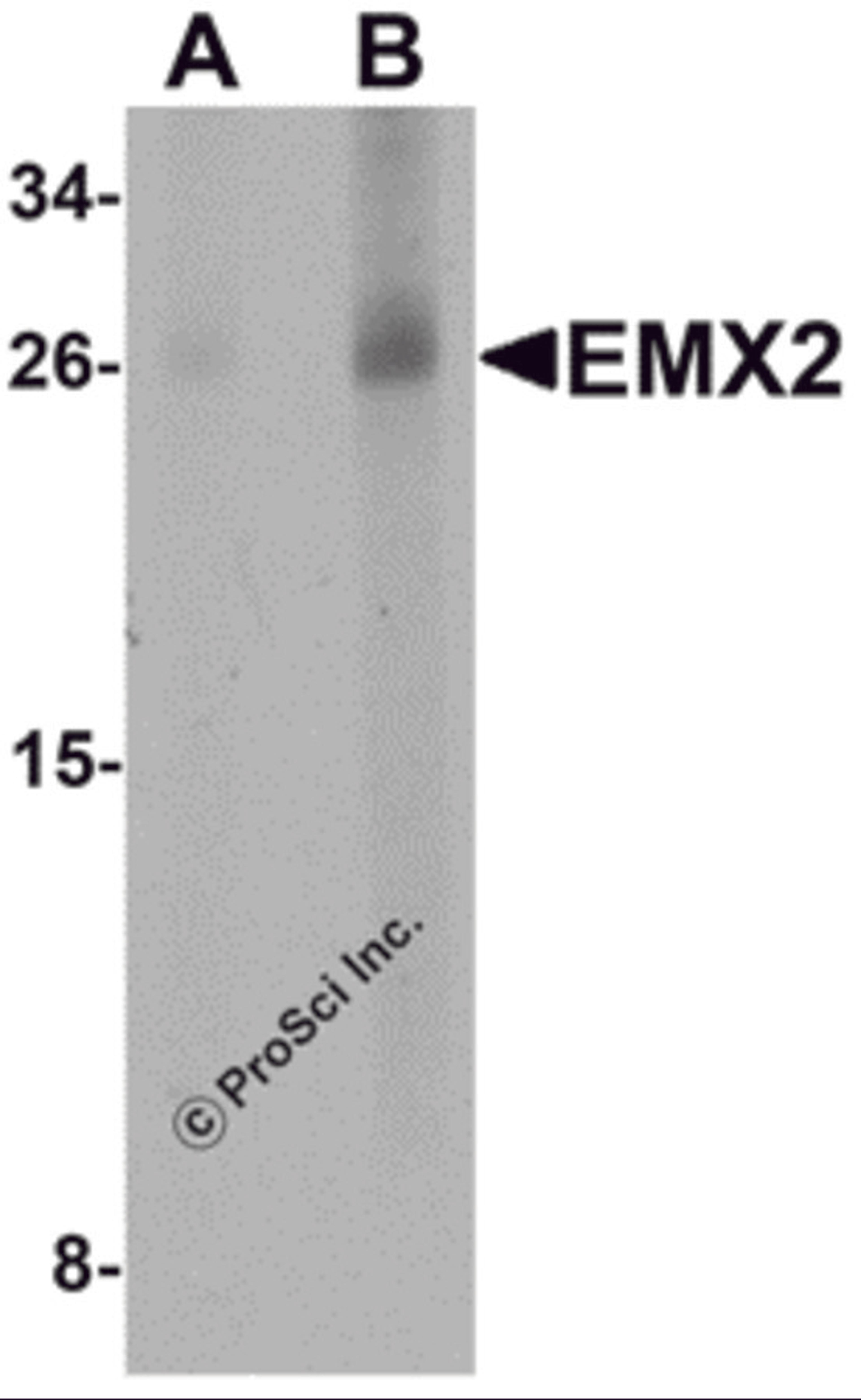 Western blot analysis of EMX2 in human lung tissue lysate with EMX2 antibody at (A) 1 and (B) 2 μg/mL.