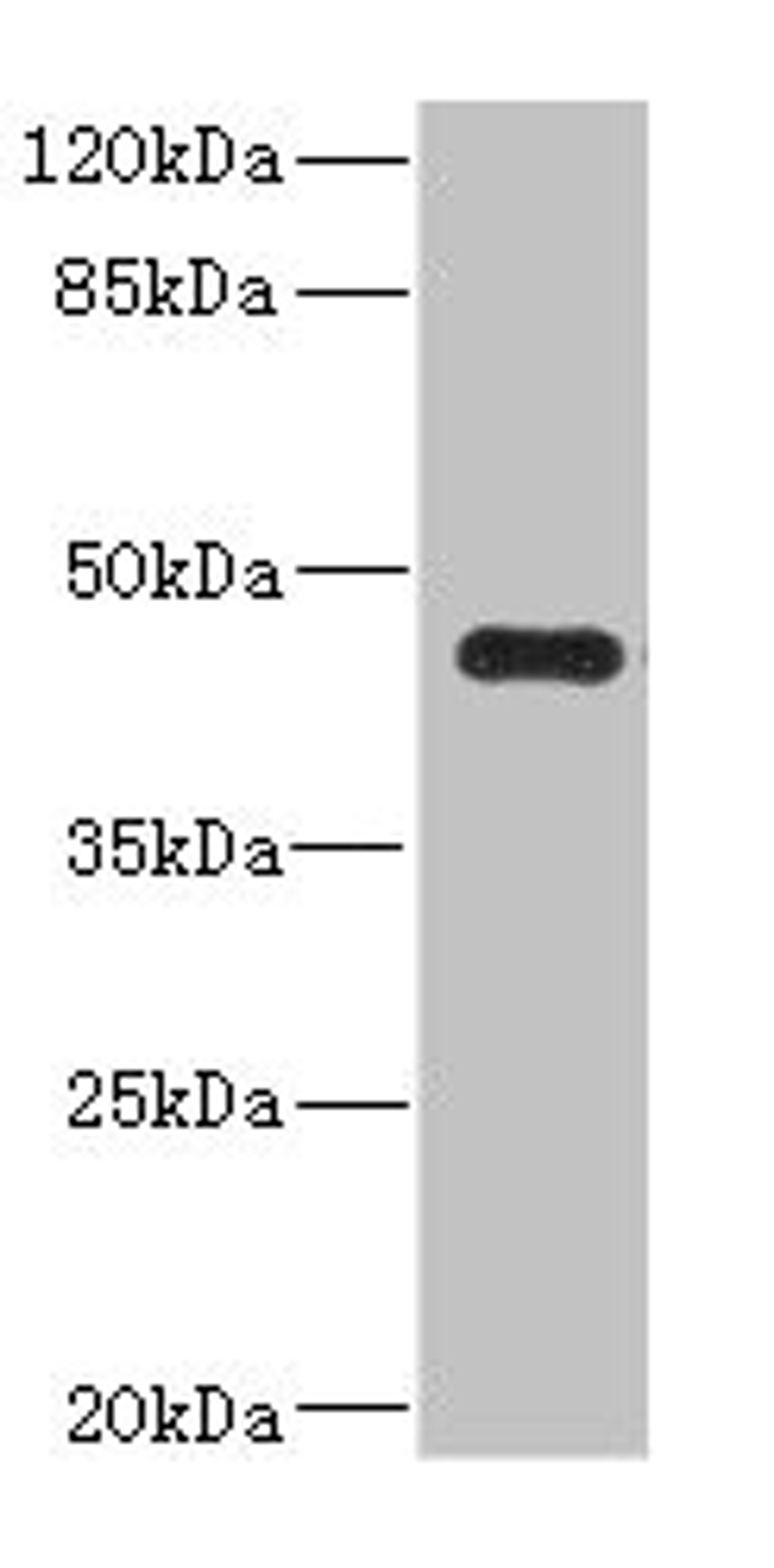 Western blot. All lanes: Ren2 antibody at 2µg/ml + MCF-7 whole cell lysate. Secondary. Goat polyclonal to rabbit IgG at 1/10000 dilution. Predicted band size: 45 kDa. Observed band size: 45 kDa