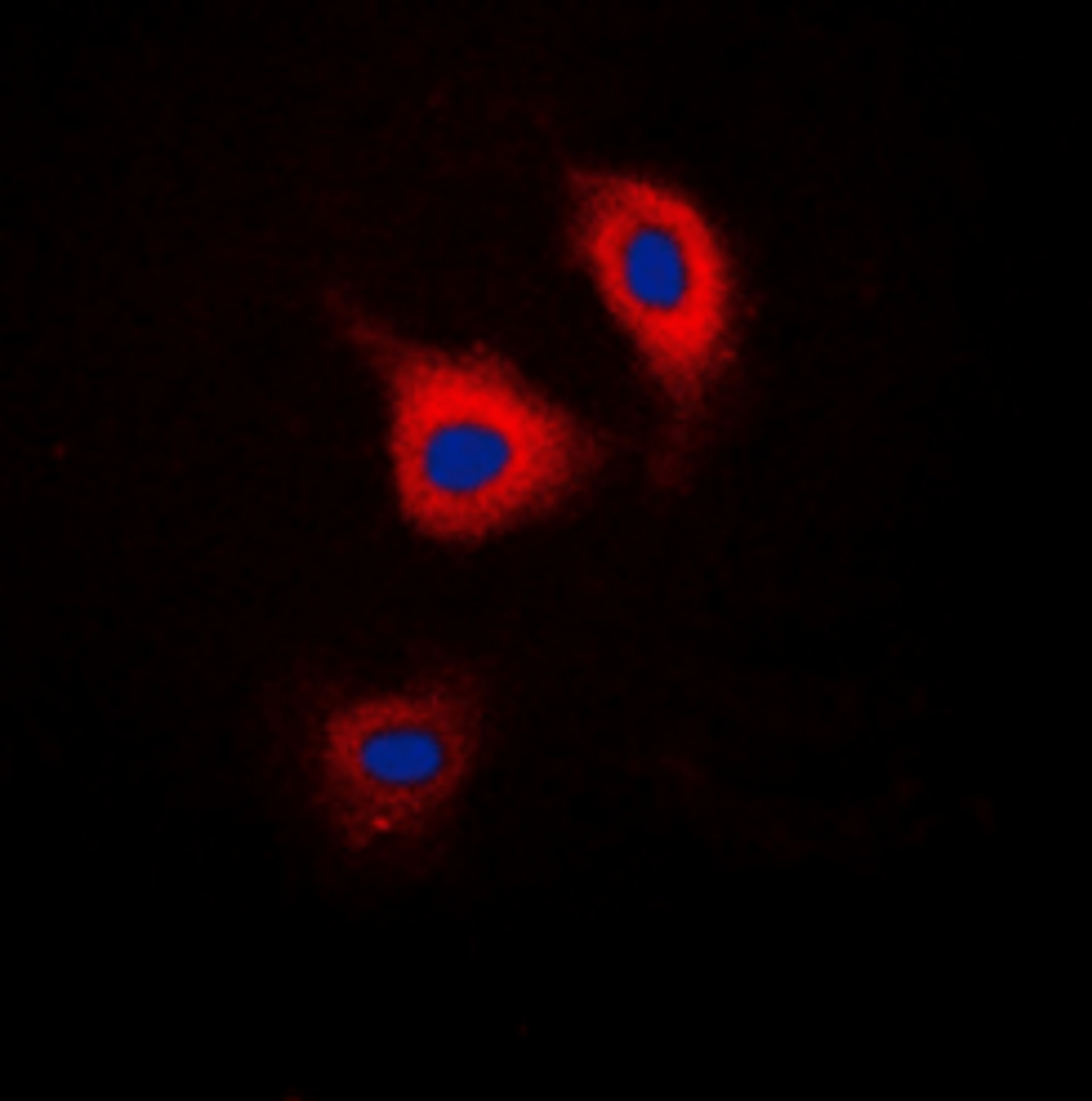 Immunofluorescence analysis of HEK293T cells using CTNND1 (Phospho-Y228) antibody