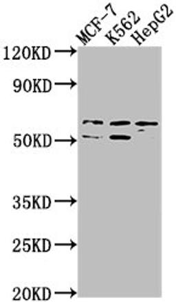 Western Blot. Positive WB detected in: MCF-7 whole cell lysate, K562 whole cell lysate, HepG2 whole cell lysate. All lanes: USP17L3 antibody at 1:1000. Secondary. Goat polyclonal to rabbit IgG at 1/50000 dilution. Predicted band size: 60 kDa. Observed band size: 60 kDa.
