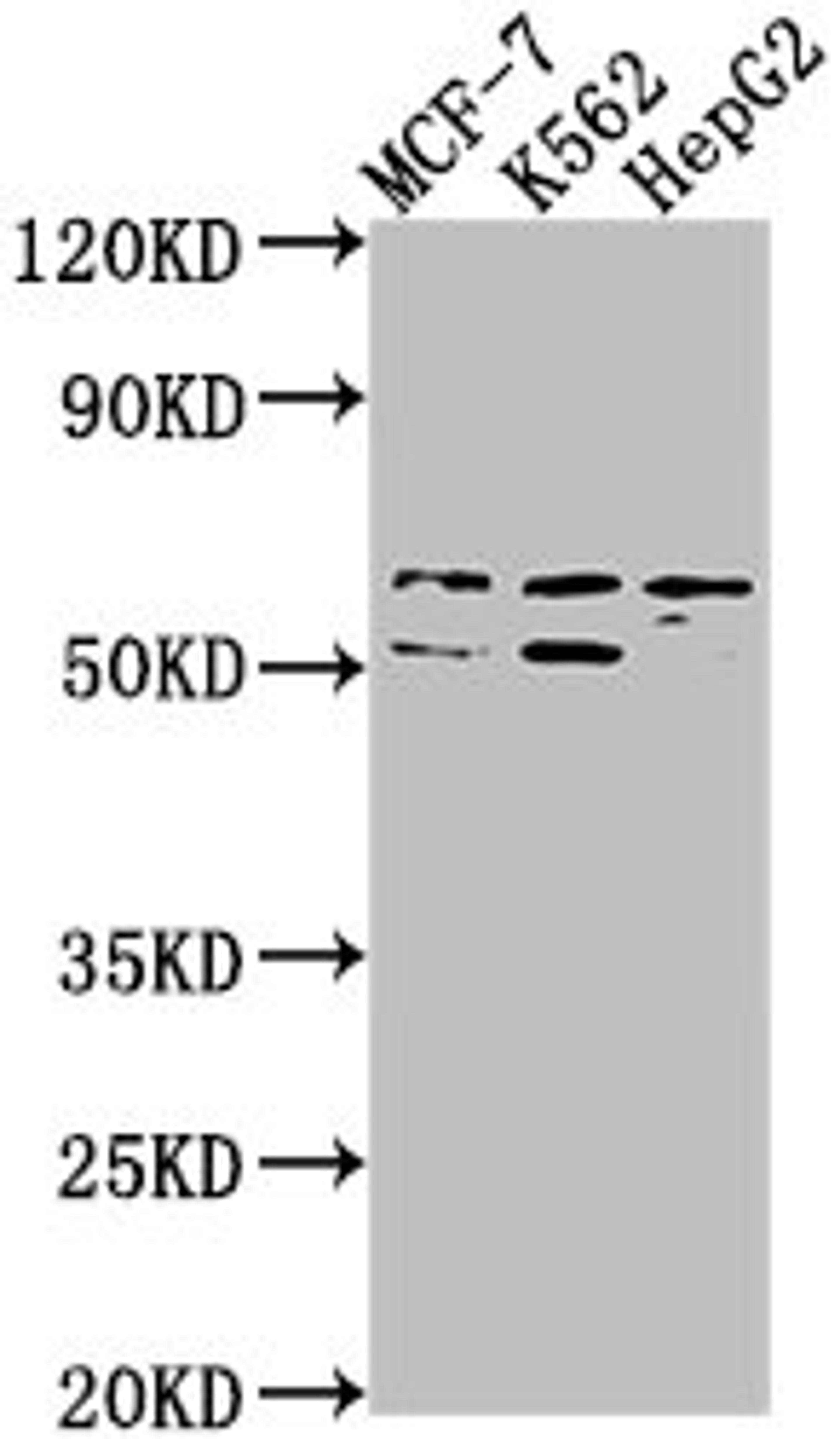 Western Blot. Positive WB detected in: MCF-7 whole cell lysate, K562 whole cell lysate, HepG2 whole cell lysate. All lanes: USP17L3 antibody at 1:1000. Secondary. Goat polyclonal to rabbit IgG at 1/50000 dilution. Predicted band size: 60 kDa. Observed band size: 60 kDa.