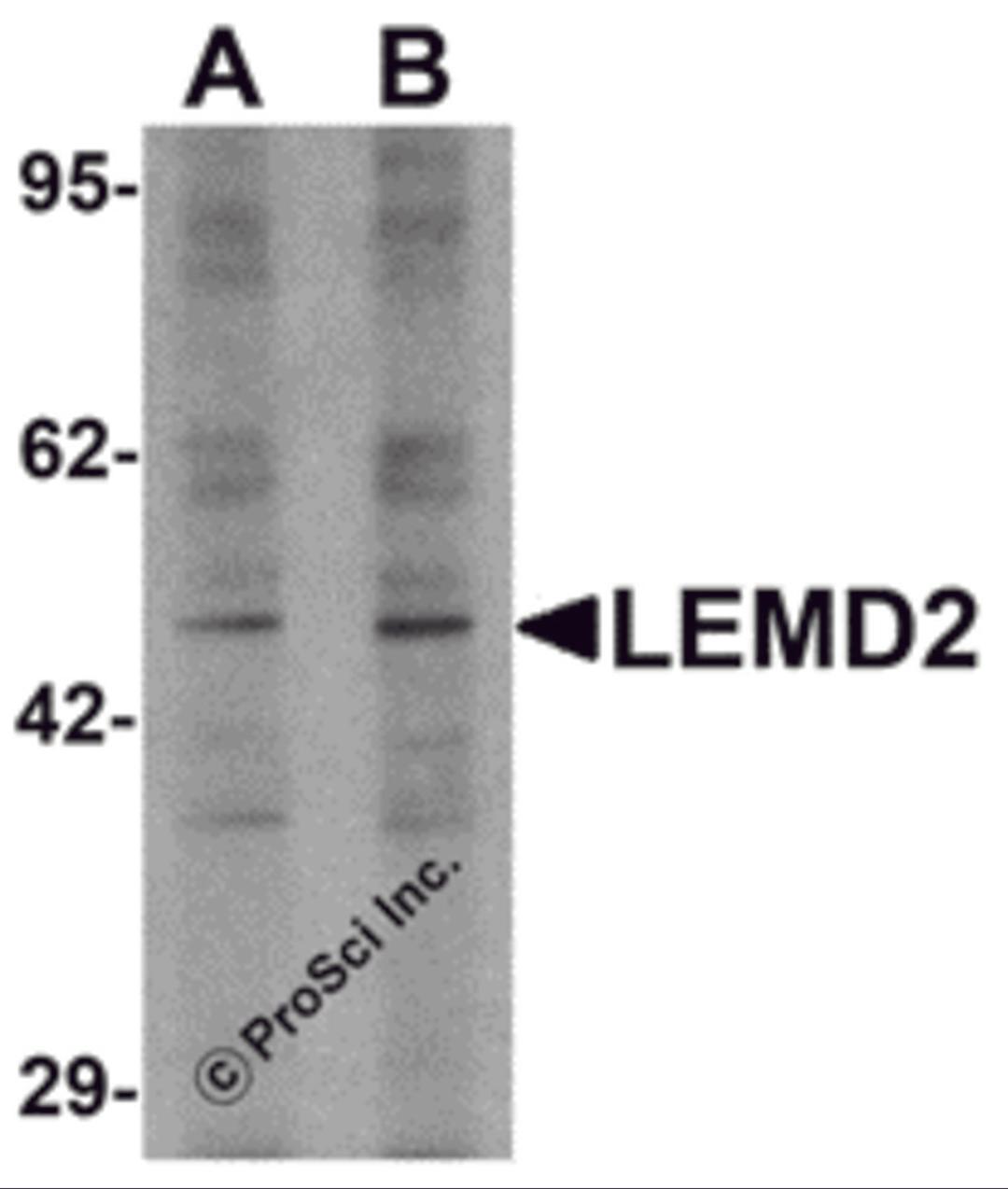 Western blot analysis of LEMD2 in 293 cell lysate with LEMD2 antibody at (A) 1 and (B) 2 &#956;g/mL.