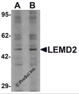 Western blot analysis of LEMD2 in 293 cell lysate with LEMD2 antibody at (A) 1 and (B) 2 μg/mL.