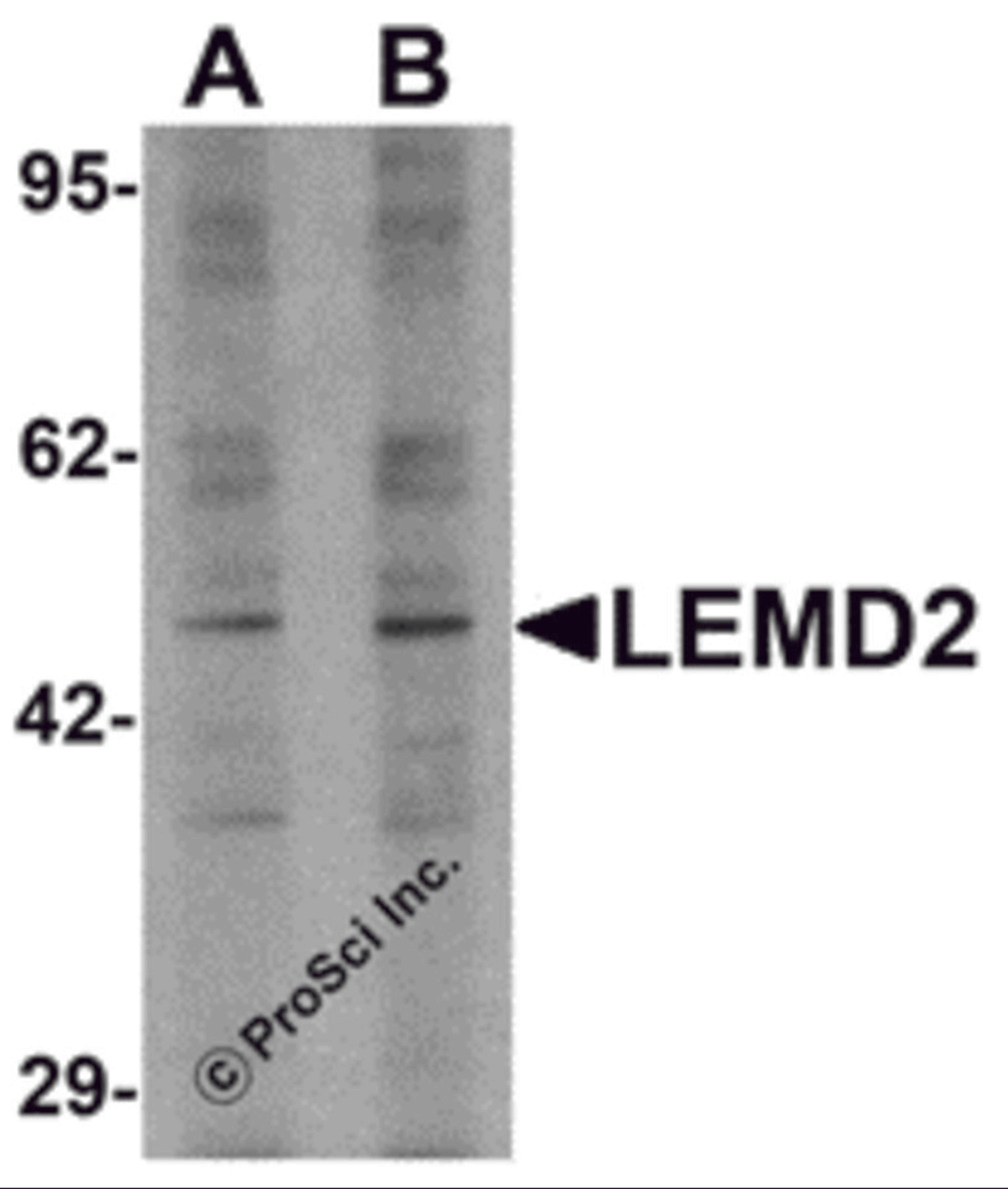 Western blot analysis of LEMD2 in 293 cell lysate with LEMD2 antibody at (A) 1 and (B) 2 μg/mL.