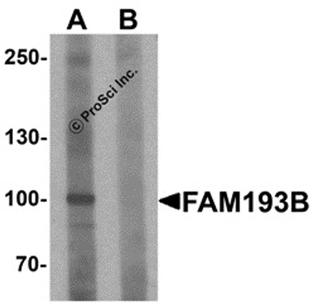Western blot analysis of FAM193B in Jurkat cell lysate with FAM193B antibody at 1 μg/mL in (A) the absence and (B) the presence of blocking peptide.