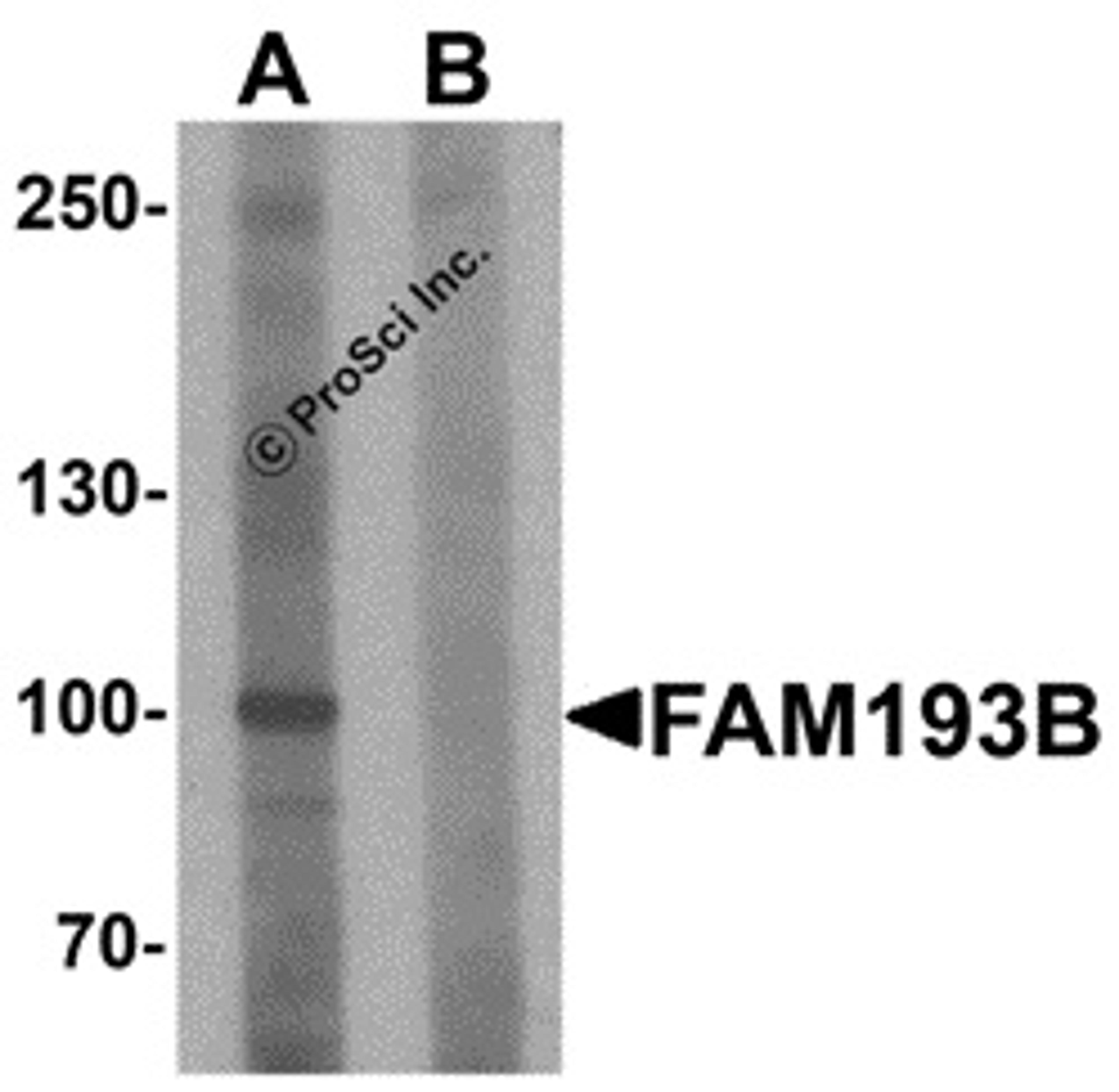 Western blot analysis of FAM193B in Jurkat cell lysate with FAM193B antibody at 1 μg/mL in (A) the absence and (B) the presence of blocking peptide.