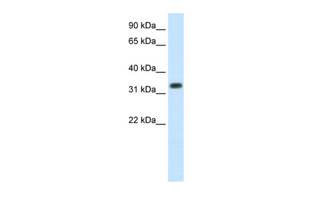 Antibody used in WB on Human Placenta at 1.25 ug/ml.