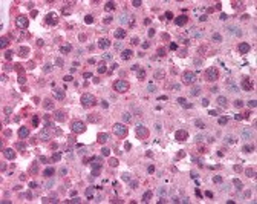 Immunohistochemistry staining of MAGEA9 in testis (formalin-fixed paraffin embedded) tissue using MAGEA9 Antibody.