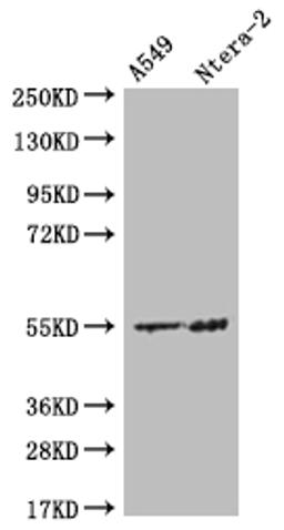 Western Blot. Positive WB detected in: A549 whole cell lysate, Ntera-2 whole cell lysate. All lanes: HMGCS2 antibody at 1:500. Secondary. Goat polyclonal to rabbit IgG at 1/50000 dilution. Predicted band size: 57, 53, 51 kDa. Observed band size: 55 kDa. 