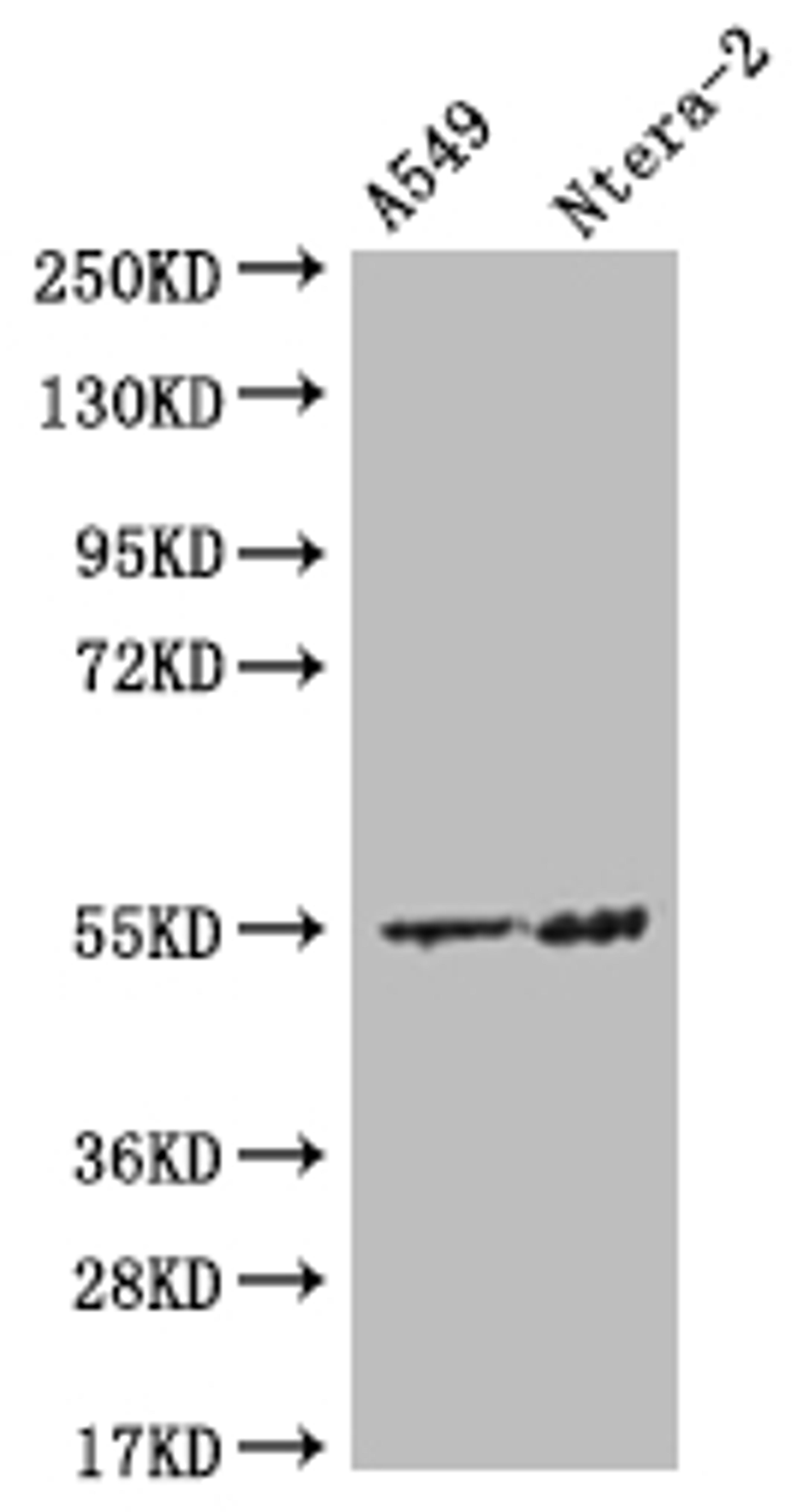 Western Blot. Positive WB detected in: A549 whole cell lysate, Ntera-2 whole cell lysate. All lanes: HMGCS2 antibody at 1:500. Secondary. Goat polyclonal to rabbit IgG at 1/50000 dilution. Predicted band size: 57, 53, 51 kDa. Observed band size: 55 kDa. 