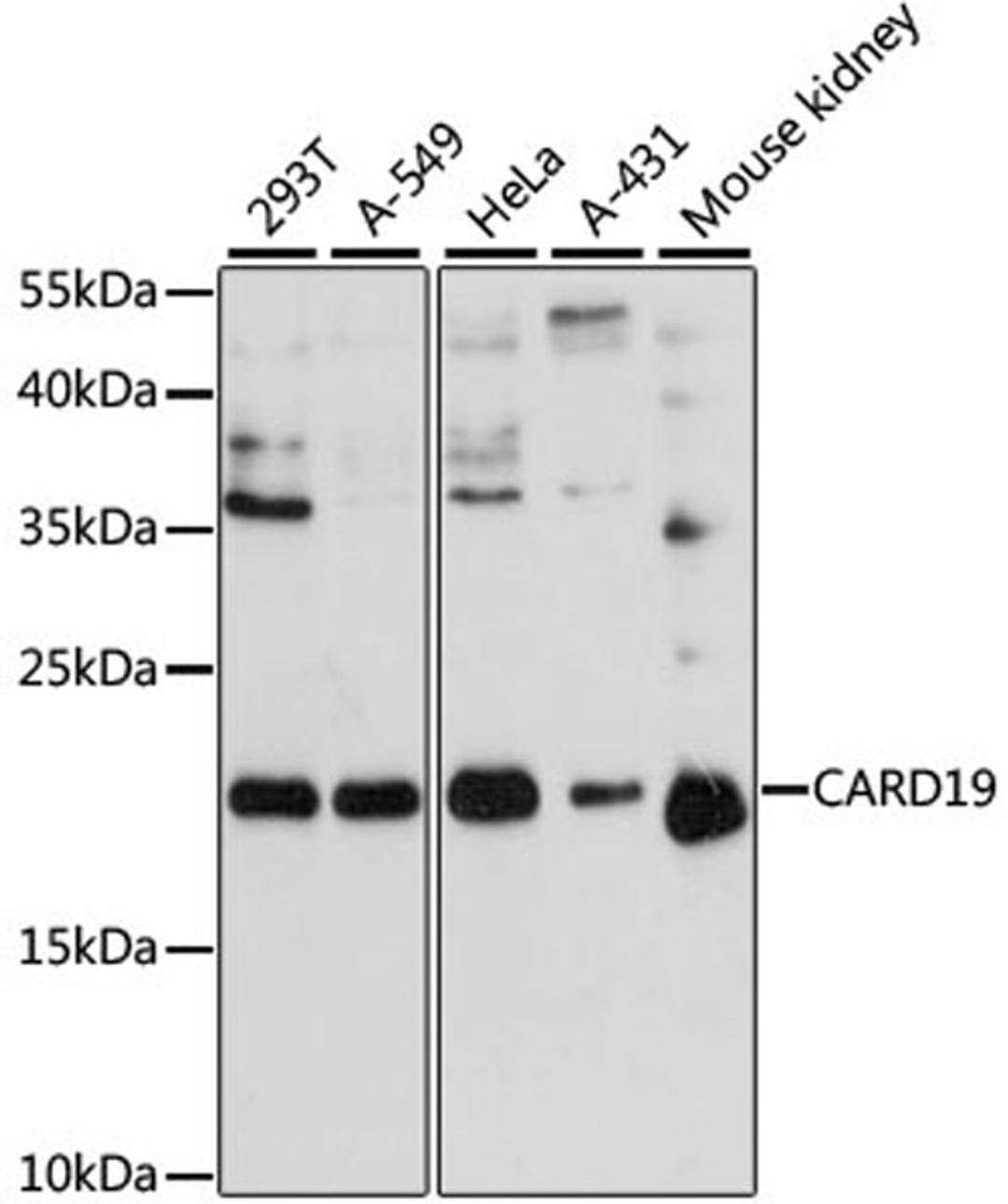 Western blot - CARD19 antibody (A13196)