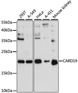 Western blot - CARD19 antibody (A13196)