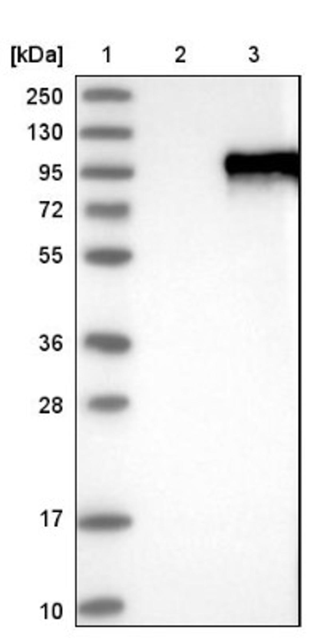 Western Blot: ZNF16 Antibody [NBP1-81343] - Lane 1: Marker [kDa] 250, 130, 95, 72, 55, 36, 28, 17, 10<br/>Lane 2: Negative control (vector only transfected HEK293T lysate)<br/>Lane 3: Over-expression lysate (Co-expressed with a C-terminal myc-DDK tag (~3.1 kDa) in mammalian HEK293T cells, LY402067)