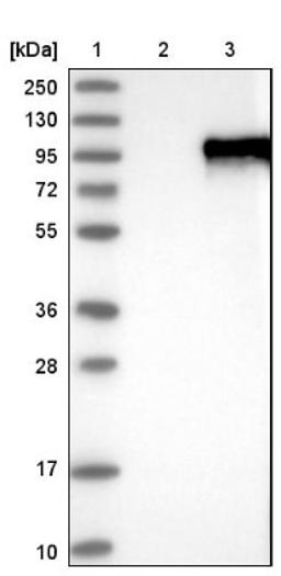 Western Blot: ZNF16 Antibody [NBP1-81343] - Lane 1: Marker [kDa] 250, 130, 95, 72, 55, 36, 28, 17, 10<br/>Lane 2: Negative control (vector only transfected HEK293T lysate)<br/>Lane 3: Over-expression lysate (Co-expressed with a C-terminal myc-DDK tag (~3.1 kDa) in mammalian HEK293T cells, LY402067)