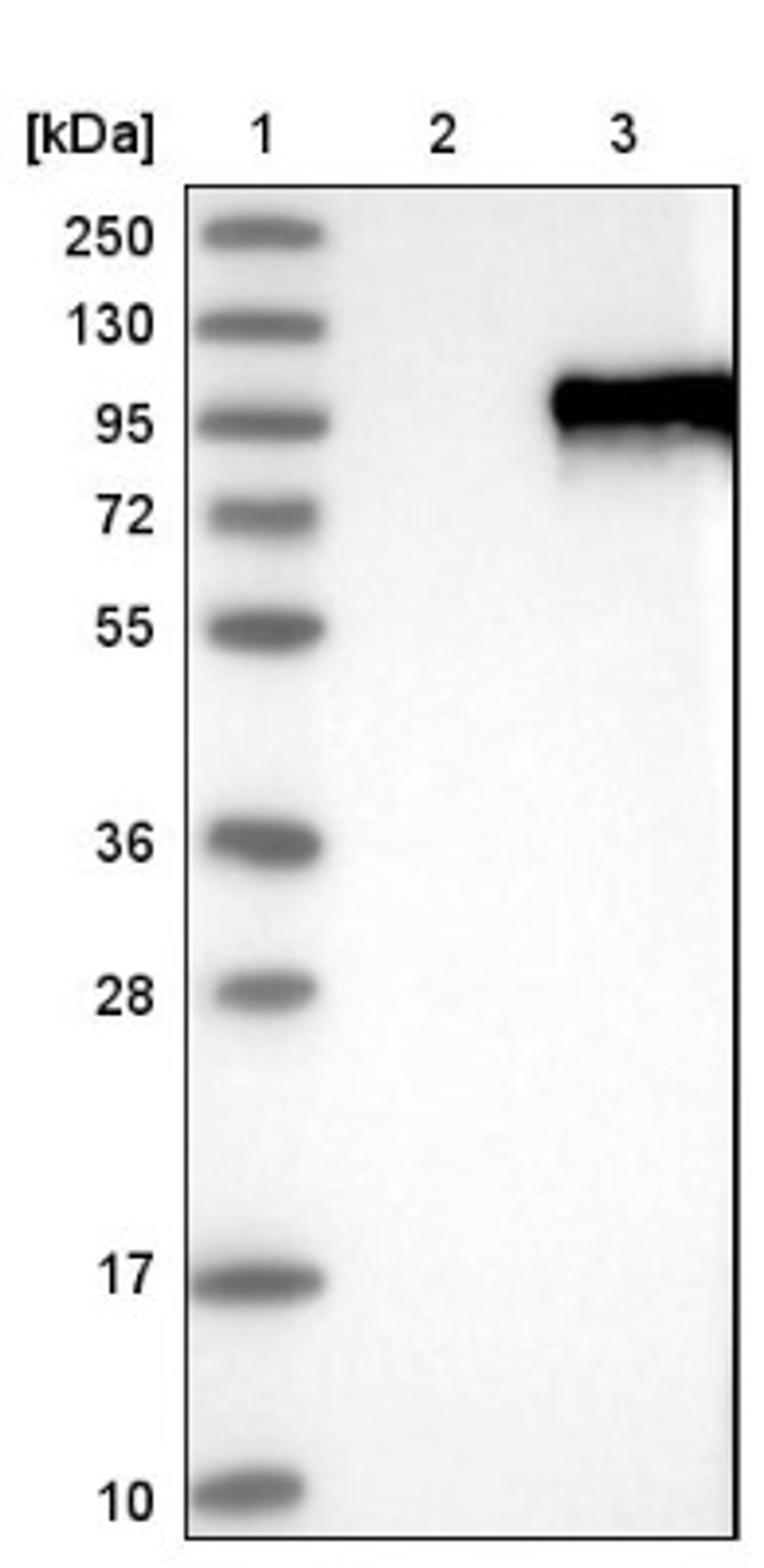 Western Blot: ZNF16 Antibody [NBP1-81343] - Lane 1: Marker [kDa] 250, 130, 95, 72, 55, 36, 28, 17, 10<br/>Lane 2: Negative control (vector only transfected HEK293T lysate)<br/>Lane 3: Over-expression lysate (Co-expressed with a C-terminal myc-DDK tag (~3.1 kDa) in mammalian HEK293T cells, LY402067)