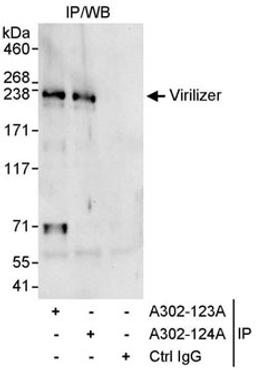 Detection of human Virilizer by western blot of immunoprecipitates.