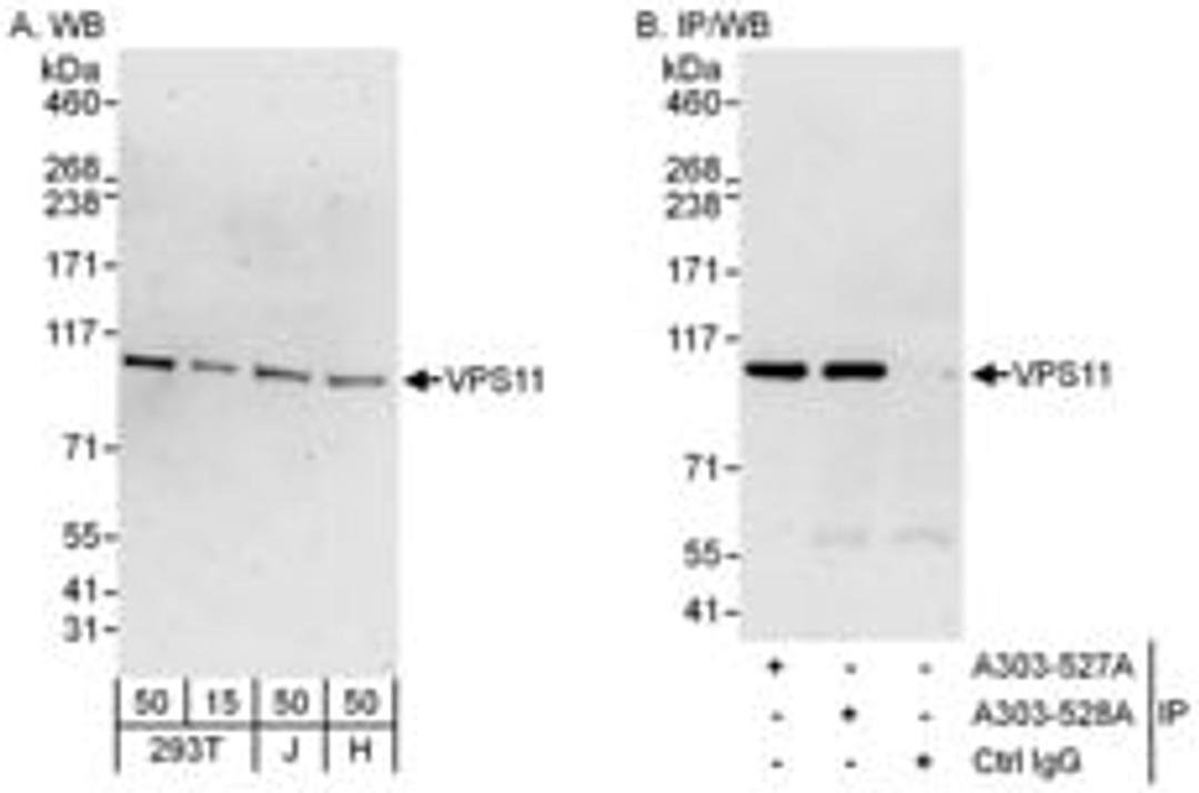 Detection of human VPS11 by western blot and immunoprecipitation.