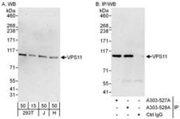 Detection of human VPS11 by western blot and immunoprecipitation.