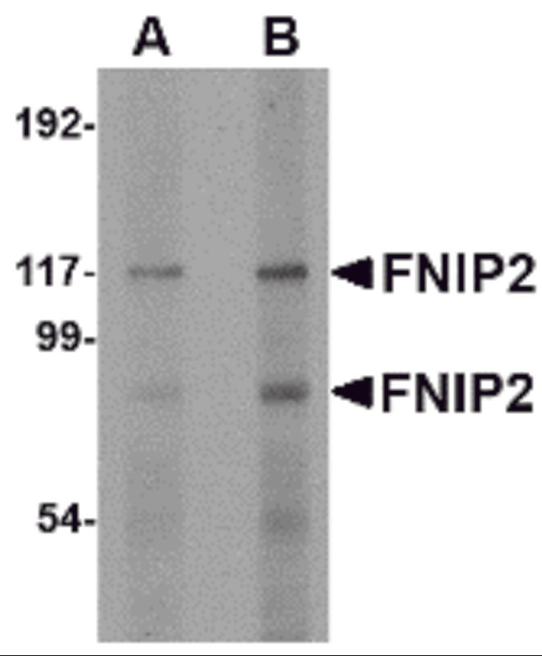 Western blot analysis of FNIP2 in rat skeletal muscle lysate with FNIP2 antibody at (A) 1 and (B) 2 μg/mL.