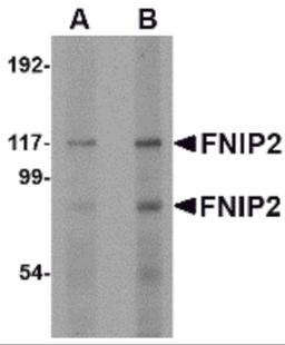 Western blot analysis of FNIP2 in rat skeletal muscle lysate with FNIP2 antibody at (A) 1 and (B) 2 μg/mL.