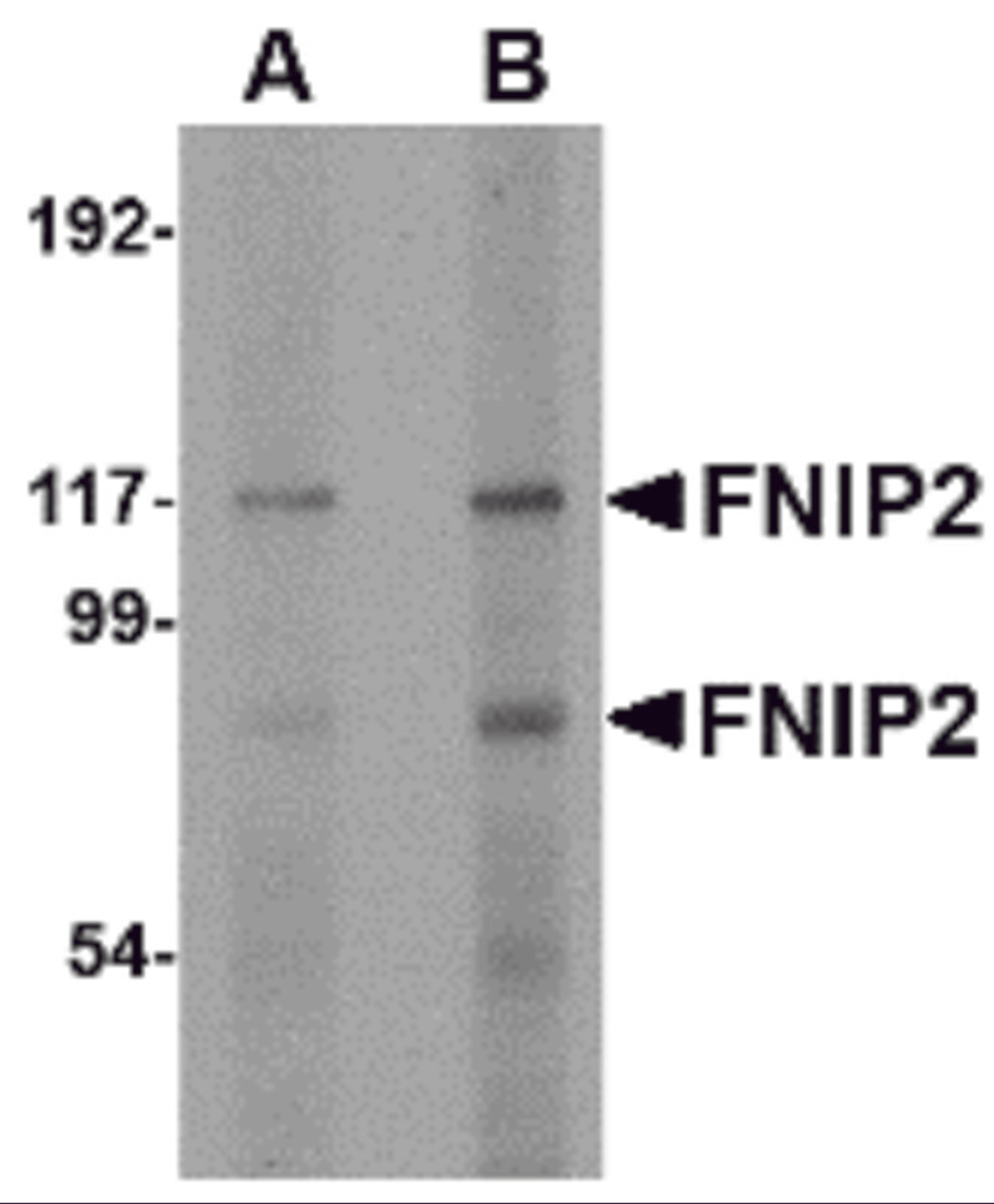 Western blot analysis of FNIP2 in rat skeletal muscle lysate with FNIP2 antibody at (A) 1 and (B) 2 μg/mL.